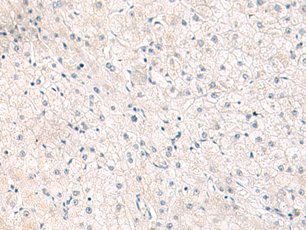 Rabbit Polyclonal Antibody to FGFR4