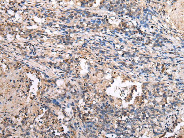 Rabbit Polyclonal Antibody to GJB1