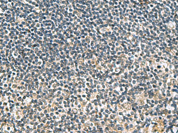 Rabbit Polyclonal Antibody to GDF10