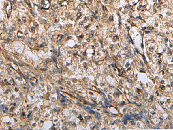 Rabbit Polyclonal Antibody to GFRA4