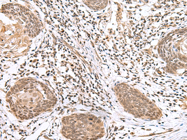 Rabbit Polyclonal Antibody to GLI2