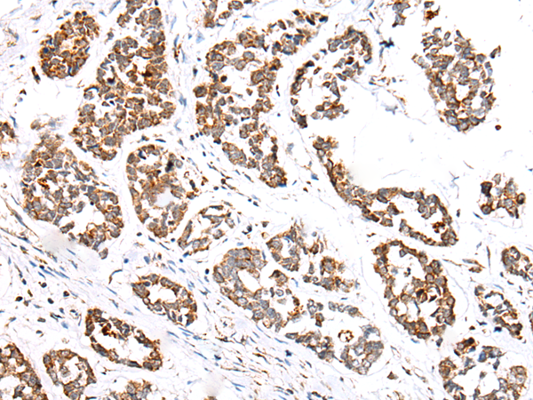 Rabbit Polyclonal Antibody to GPC1