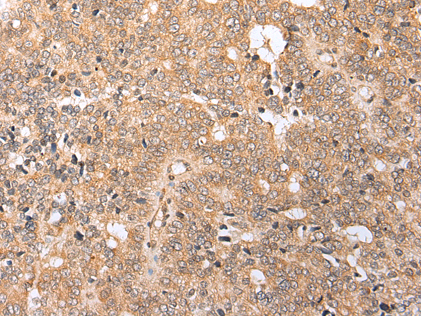 Rabbit Polyclonal Antibody to COX8C