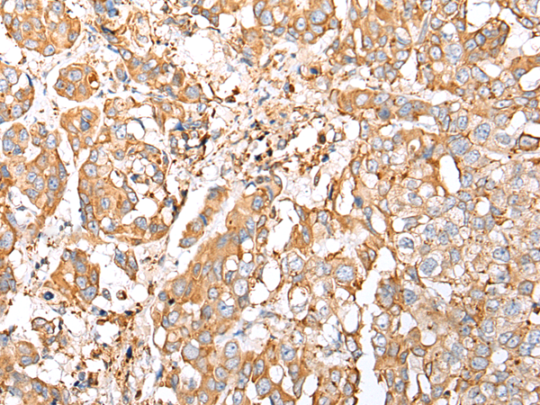 Rabbit Polyclonal Antibody to COX7A2L