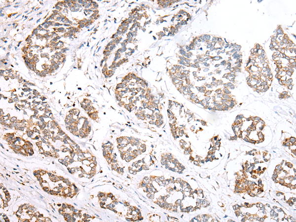 Rabbit Polyclonal Antibody to NLRP1