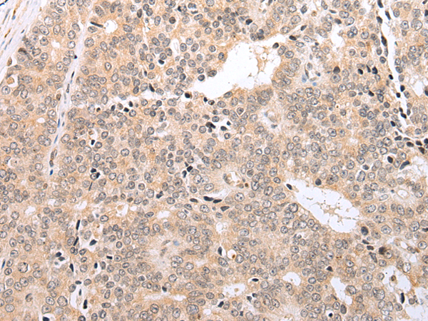 Rabbit Polyclonal Antibody to BMF