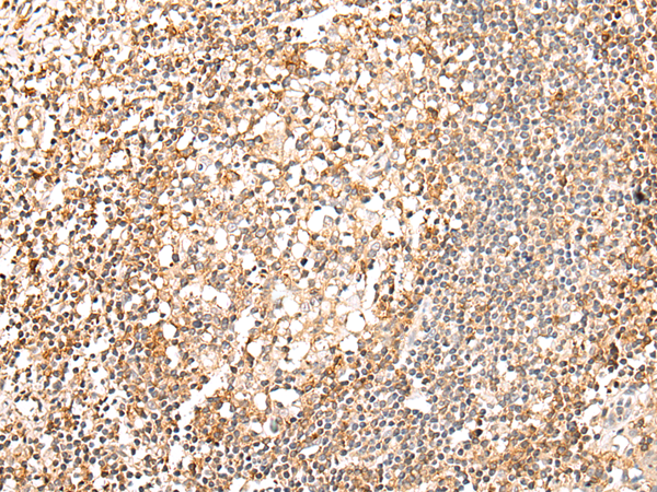 Rabbit Polyclonal Antibody to HTR1B