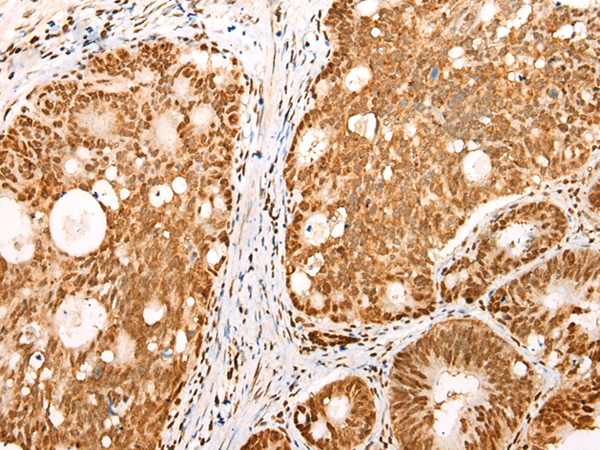 Rabbit Polyclonal Antibody to NDUFB2