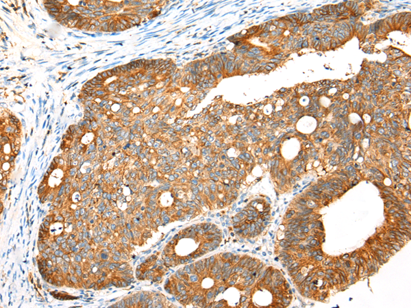 Rabbit Polyclonal Antibody to EML4