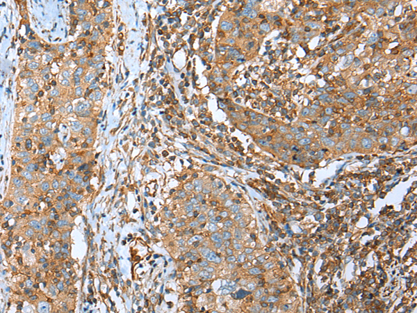 Rabbit Polyclonal Antibody to TRPV6