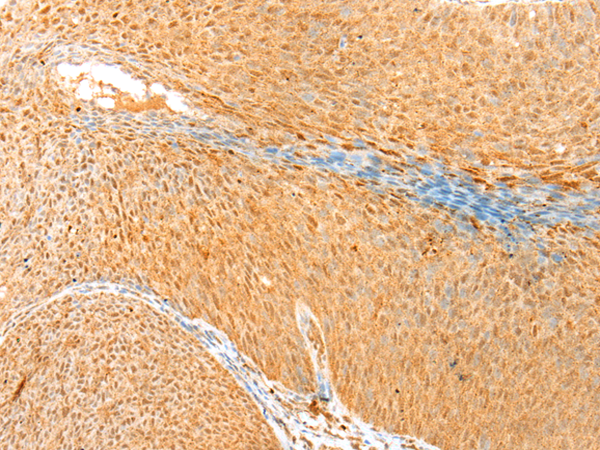 Rabbit Polyclonal Antibody to CCNG1