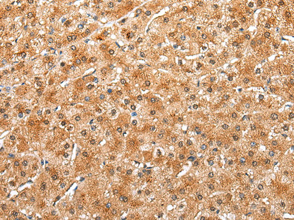 Rabbit Polyclonal Antibody to DRD3