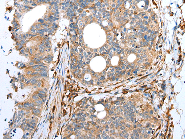 Rabbit Polyclonal Antibody to SDCCAG8