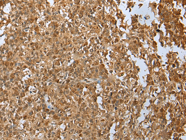 Rabbit Polyclonal Antibody to DEK