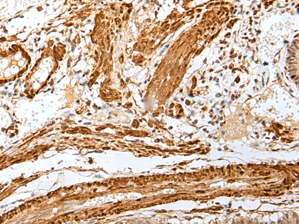 Rabbit Polyclonal Antibody to PF4