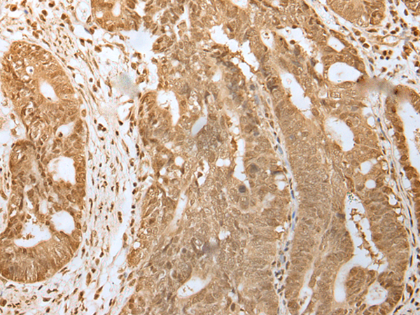 Rabbit Polyclonal Antibody to HDAC5