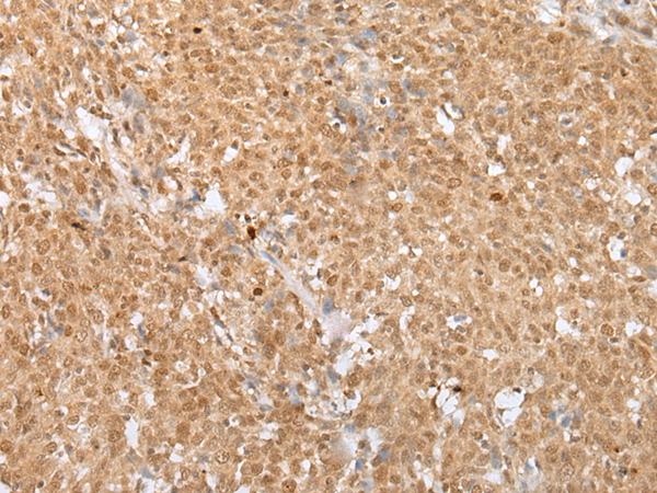 Rabbit Polyclonal Antibody to MAFA