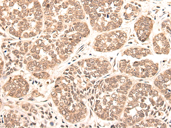 Rabbit Polyclonal Antibody to MAFB