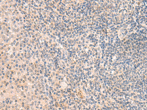 Rabbit Polyclonal Antibody to GRM2