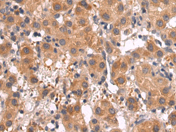 Rabbit Polyclonal Antibody to GRM5