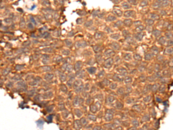 Rabbit Polyclonal Antibody to HOXD8