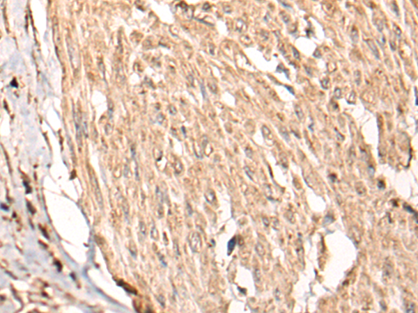 Rabbit Polyclonal Antibody to HSF4