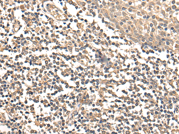 Rabbit Polyclonal Antibody to LPL