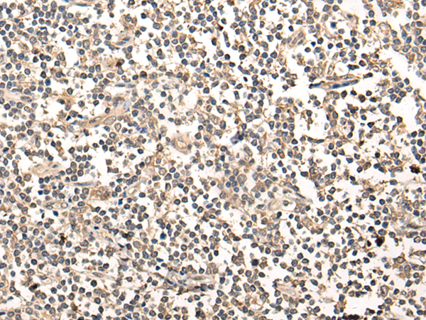 Rabbit Polyclonal Antibody to MAGEA1