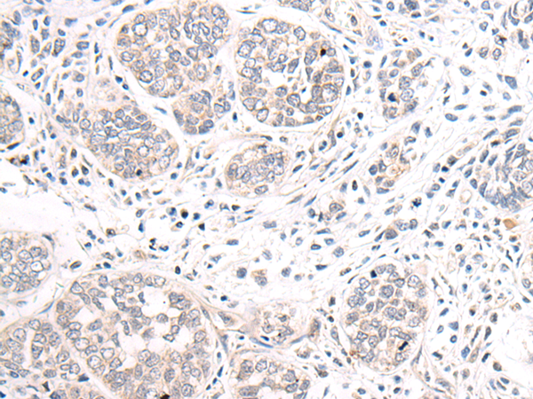 Rabbit Polyclonal Antibody to GABRB1