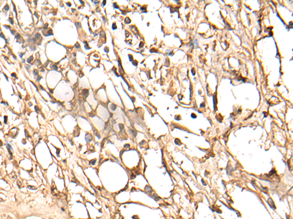 Rabbit Polyclonal Antibody to ABCC4