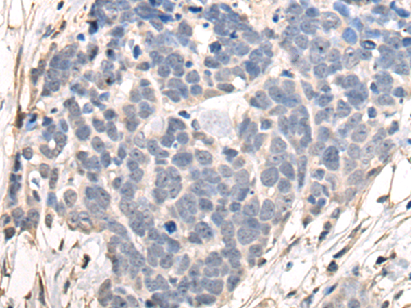 Rabbit Polyclonal Antibody to MYLK