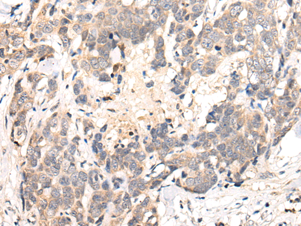 Rabbit Polyclonal Antibody to CHRNA6