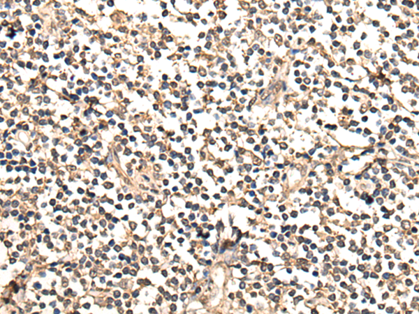 Rabbit Polyclonal Antibody to NES