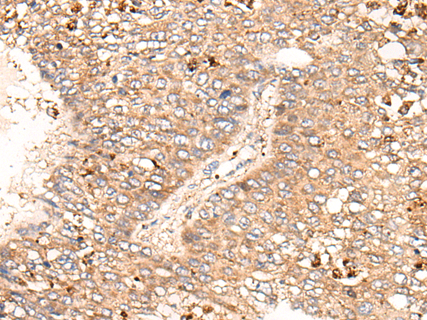 Rabbit Polyclonal Antibody to GRIA4