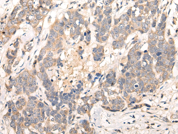 Rabbit Polyclonal Antibody to LPAR6