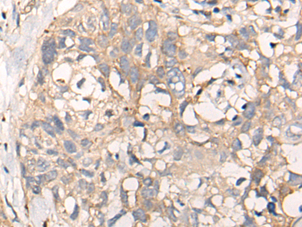 Rabbit Polyclonal Antibody to NREP