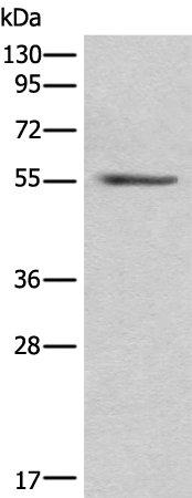 Rabbit Polyclonal Antibody to GFAP