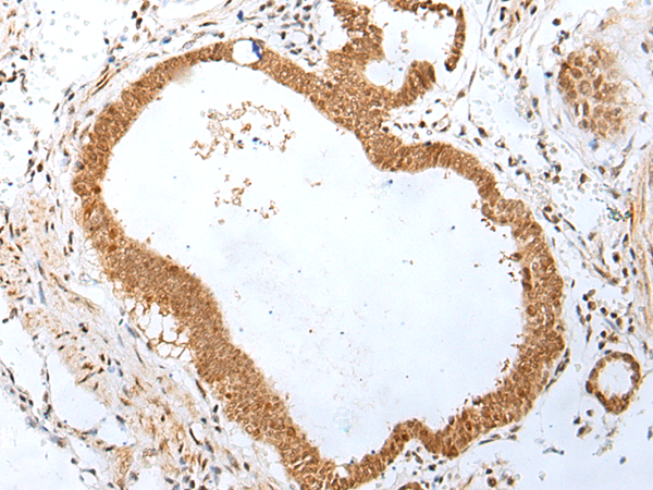 Rabbit Polyclonal Antibody to PEG3