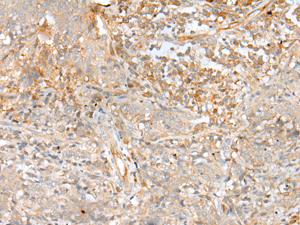 Rabbit Polyclonal Antibody to A2M
