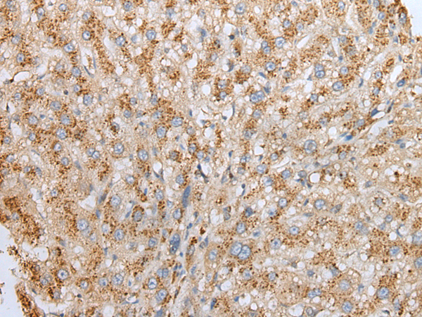 Rabbit Polyclonal Antibody to SLC25A21