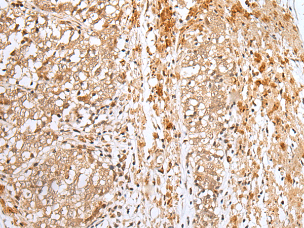 Rabbit Polyclonal Antibody to NPHS1