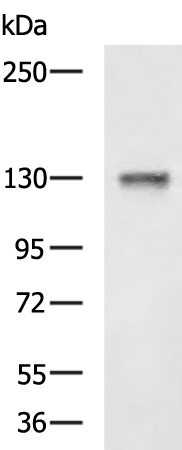 Rabbit Polyclonal Antibody to NCAN