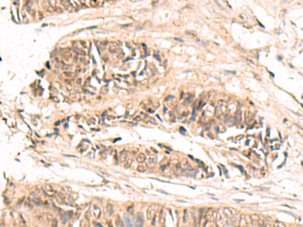 Rabbit Polyclonal Antibody to ABCB4