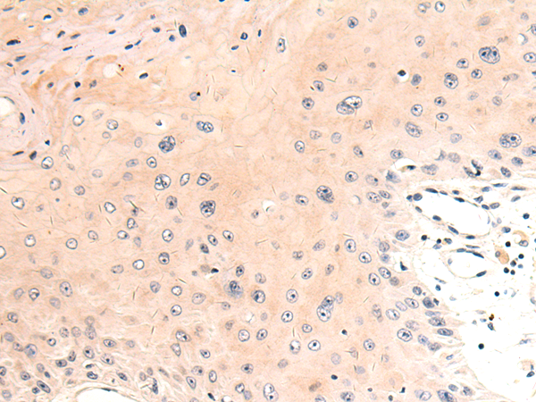 Rabbit Polyclonal Antibody to ABCB10