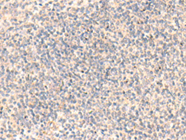 Rabbit Polyclonal Antibody to ADAMTS2