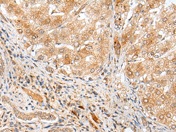 Rabbit Polyclonal Antibody to ADAMTS3