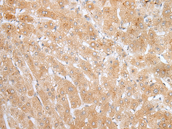 Rabbit Polyclonal Antibody to ADAMTS8