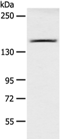 Rabbit Polyclonal Antibody to AGL