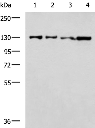 Rabbit Polyclonal Antibody to SLC4A3
