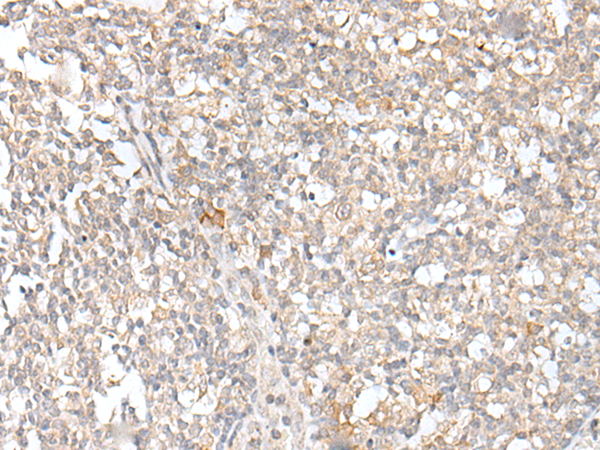 Rabbit Polyclonal Antibody to KLRC3